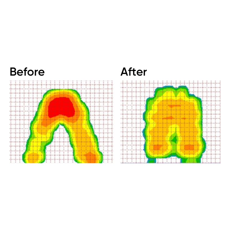 CarePlus Double Layer Air Cushion For Pressure Relief