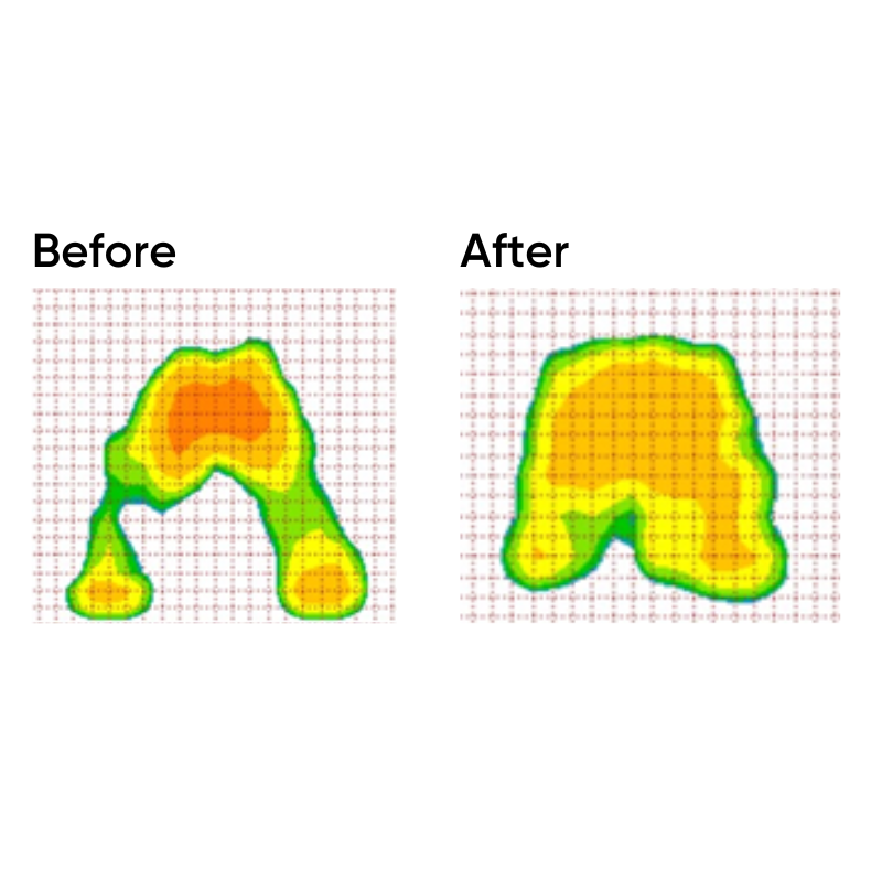 CarePlus Single Layer Air Cushion For Pressure Relief