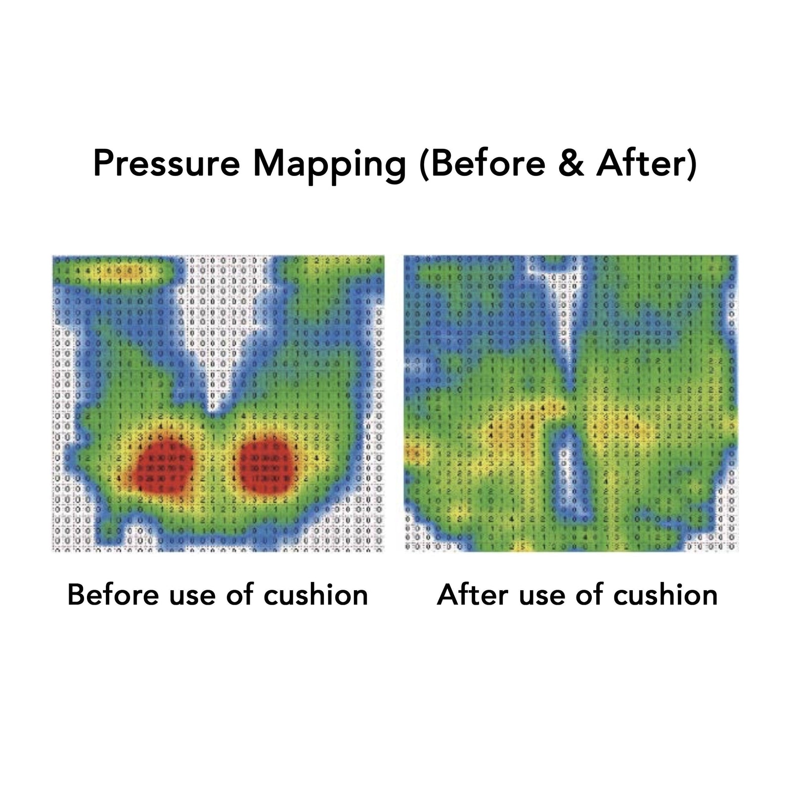 Ergo Pressure Relief Wheelchair Cushion