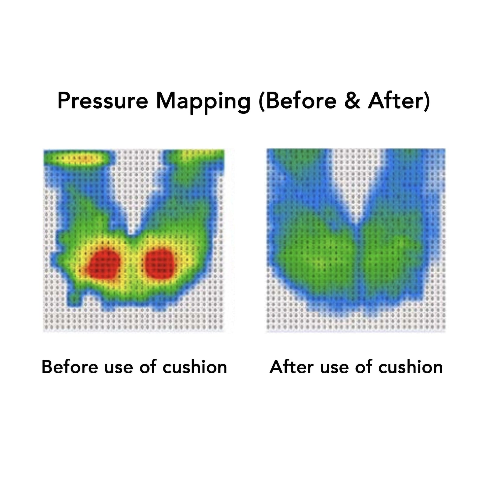 ErgoGel Pressure Relief Seat Cushion